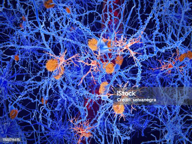 Microglia Cells Play An Important Role In The Pathogenesis Of Alzheimers Disease Stock Photo - Download Image Now