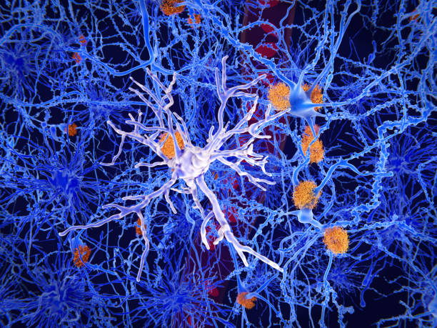 A microglia cell in the foreground. It plays an important role in the pathogenesis of Alzheimer's disease Microglia are specialised macrophages that restrain the accumulation of ß-amyloid (plaques in orange). On the other side, once activated, they can have harmful influences in Alzheimer's disease, segregating inflammatory factors and mediating the engulfment of synapses. central nervous system photos stock pictures, royalty-free photos & images