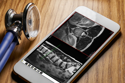 Stethoscope and smartphone with x ray on screen