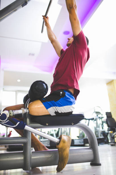 istock Young man with prosthetic leg in the gym 1155250449