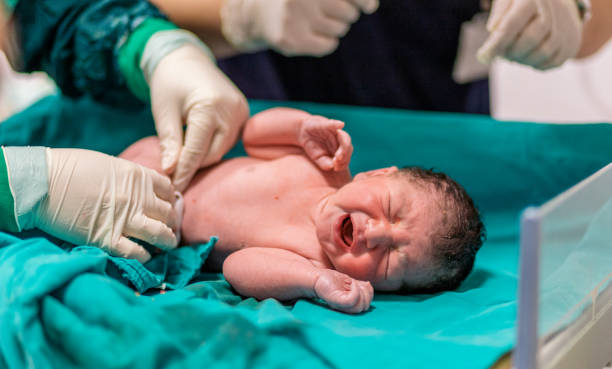 医師は、赤ちゃんの臍帯を切断 - 誕生 ストックフォトと画像