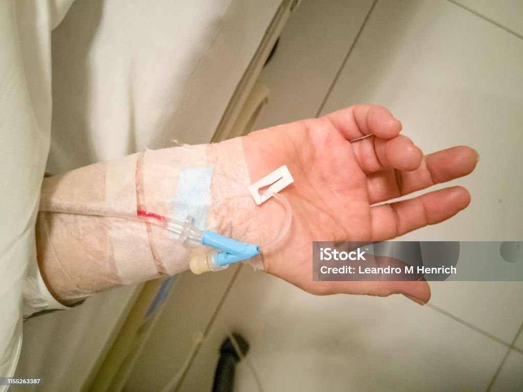 adult women´s hand with an intravenous line adult women 60s with saline at C-line or A-line on a ypung adult patient hand on bed in intensive care unit (ICU) shock room Catheter Stock Photo