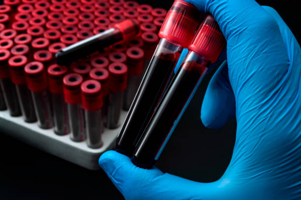 istock Blood analysis, clinical or medical testing and phlebotomy concept theme with close up on doctor hand wearing blue latex gloves and holding a test tubes isolated on black background 1155354069