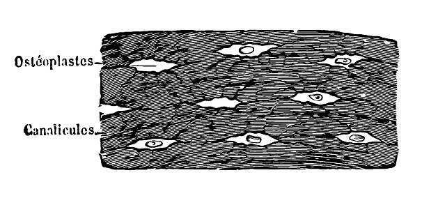 Illustration of a Branched osteoplasts