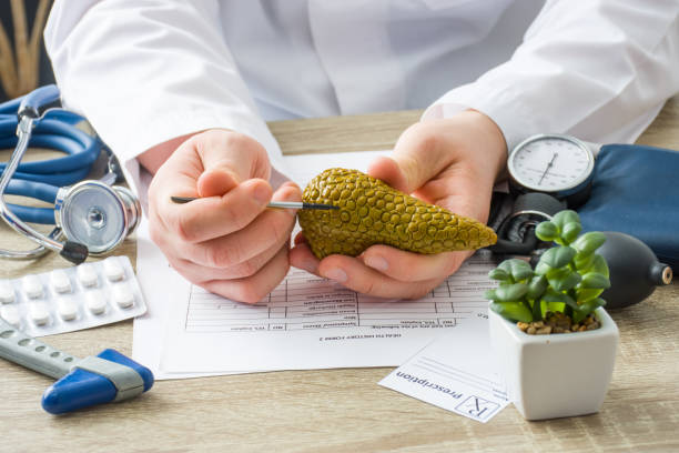 en la cita del médico muestra la forma del paciente de la glándula del páncreas con enfoque en la mano con el órgano. escena que explica las causas del paciente y la localización de enfermedades del páncreas, enzima, digestión - páncreas fotos fotografías e imágenes de stock