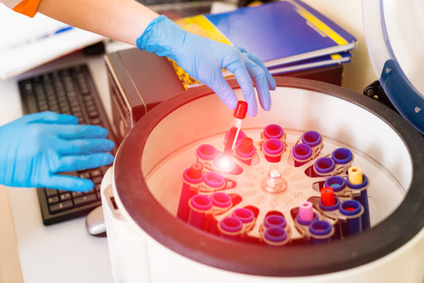 istock Doctor putting tubes of blood in centrifugal machine for testing and analyzing 1155497196