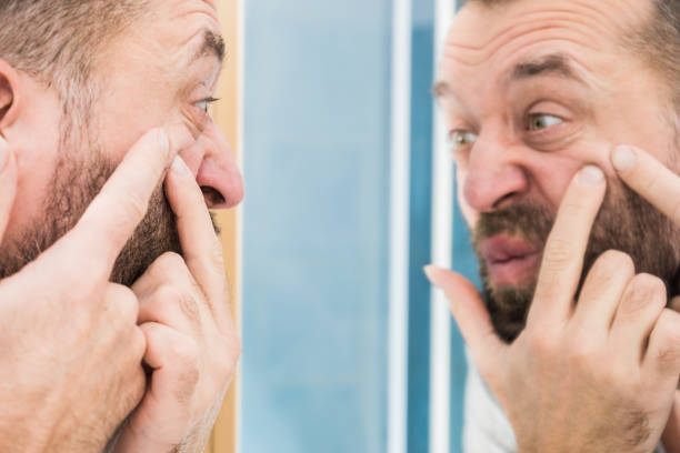 istock Man looking at pimples on his face 1156273691
