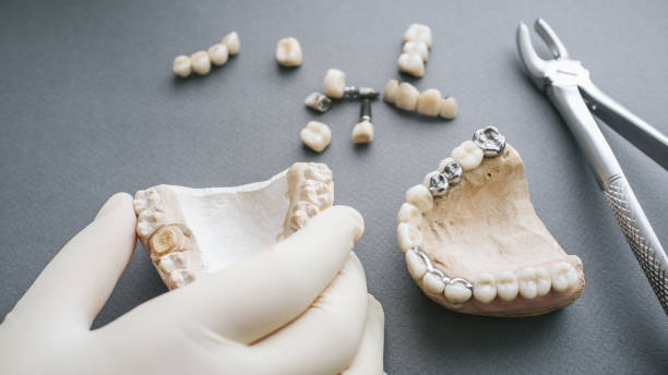 istock Orthodontic prosthetics gypsym jaw denture forceps 1156351252