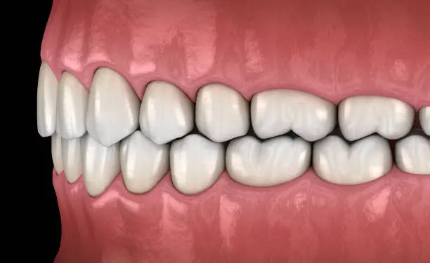 Healthy human teeth with normal occlusion, side view. Medically accurate tooth 3D illustration