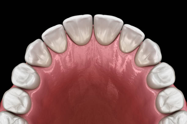 istock Maxillary human gum and teeth. Medically accurate tooth 3D illustration 1156477510