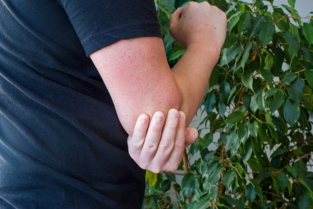 Pain in elbow concept photo. Person holds with palm of other hand over area of ​​elbow due to occurrence of severe pain due to inflammation of joint, muscle or tendon, entrapment, injury, stroke Pain in elbow concept photo. Person holds with palm of other hand over area of ​​elbow due to occurrence of severe pain due to inflammation of joint, muscle or tendon, entrapment, injury, stroke entrapment stock pictures, royalty-free photos & images