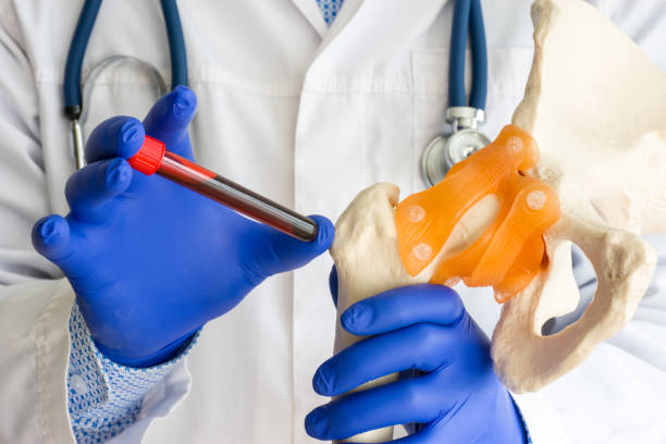 실험실 의료 진단, 뼈및 관절 개념 사진에 대한 테스트. 의사 또는 실험실 기술자가 혈액이있는 한 손 실험실 테스트 튜브에 들고, 다른 한편으로는 뼈와 엉덩이 관절의 모델을 보유합니다. - rheumatic 뉴스 사진 이미지