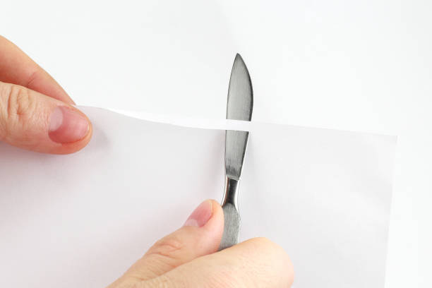 istock check sharpening blades medical scalpel on paper 1156540588