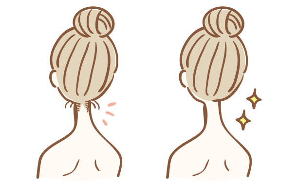 ilustrações, clipart, desenhos animados e ícones de depilação antes e depois do nuca - nape