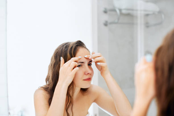Young woman  looking and squeeze  acne on a face in front of the mirror. Ugly problem skin girl, teen girl having pimples. Skin care. Beauty stock photo