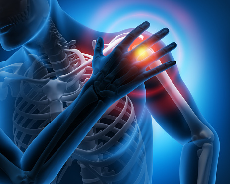 Pain in the Shoulder Joint - Medical Illustration - 3D Rendering