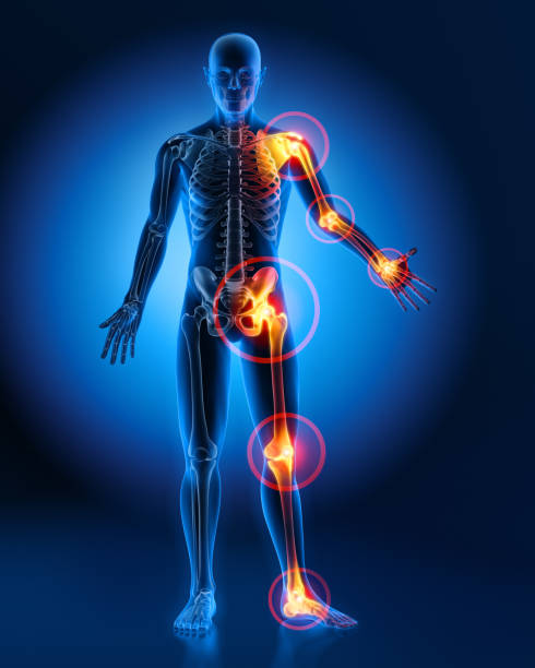pain in all joints-conceptual artwork-3d illustration - rheumatism imagens e fotografias de stock