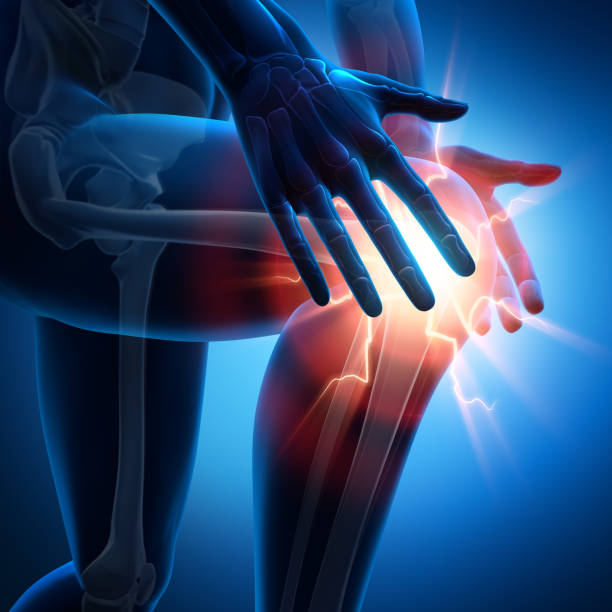 니에슈메르즈 - 컨셉 아트워크 - 3d 일러스트레이션 - human bone x ray image pain condition 뉴스 사진 이미지