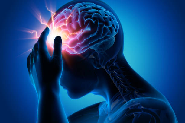 Headache-conceptual artwork-3d illustration Severe Headache - Migraine - Medical Illustration - 3D Rendering concussion stock pictures, royalty-free photos & images