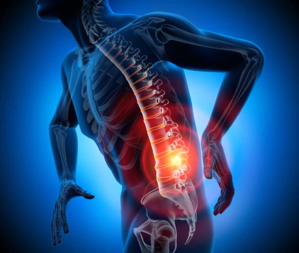 istock Back pain-conceptual artwork-3d illustration 1156927865
