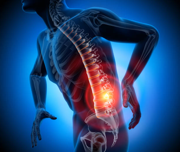 Back pain-conceptual artwork-3d illustration 3D Rendering - Severe pain in the spine and intervertebral discs - Herniated disc back pain stock pictures, royalty-free photos & images