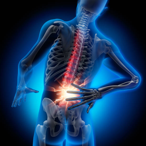 Back pain-conceptual artwork-3d illustration 3D Rendering - Severe pain in the spine and intervertebral discs - Herniated disc lower back pain stock pictures, royalty-free photos & images