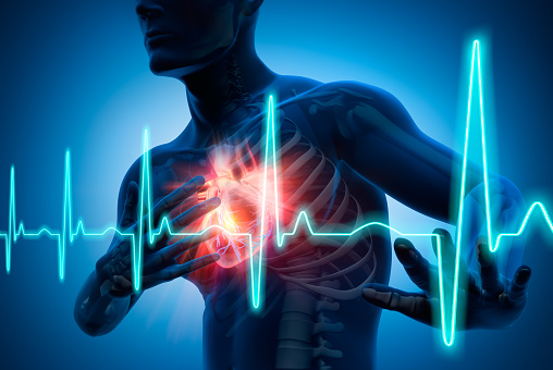 3D Rendering - Chest Pain - Heart Attack - Medical Illustration