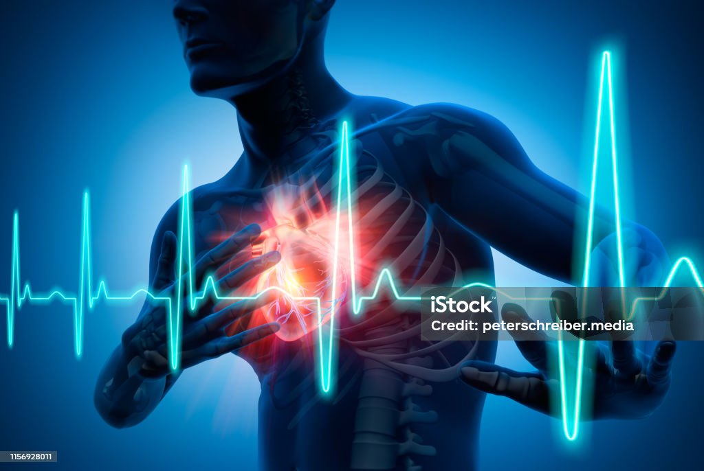 Heart attack heart attack conceptual artwork-3d illustration 3D Rendering - Chest Pain - Heart Attack - Medical Illustration Heart Attack Stock Photo