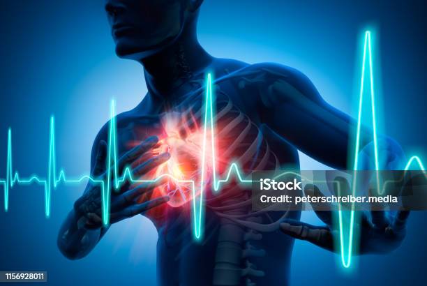 Heart Attack Heart Attack Conceptual Artwork3d Illustration Stock Photo - Download Image Now