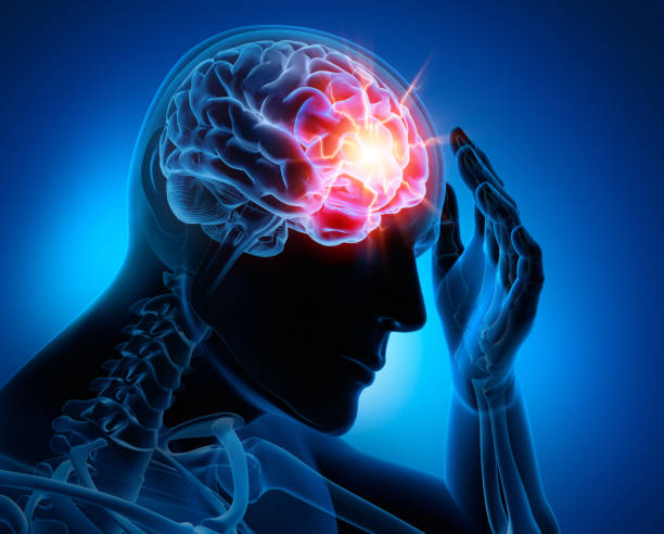 Headache-conceptual artwork-3d illustration Severe Headache - Migraine - Medical Illustration - 3D Rendering concussion stock pictures, royalty-free photos & images