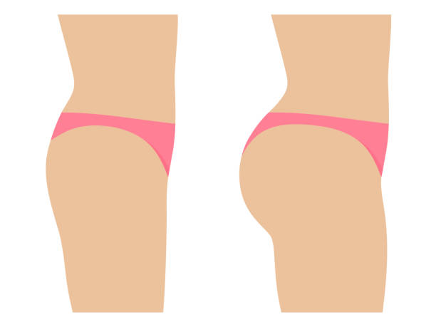 Female ass before and after plastic surgery Female ass before and after plastic surgery. Concept of an increase in the buttocks. Vector illustration isolated on white, side view profile. flat buttocks stock illustrations