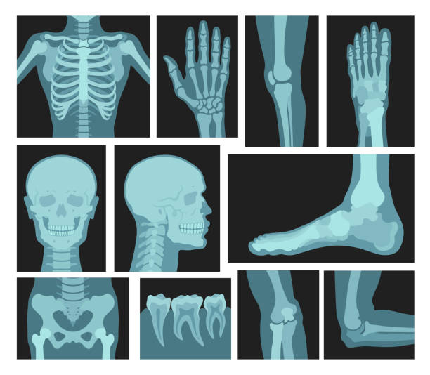 i̇nsan vücudunun x ışınları, tıbbi ekipmanlar - röntgen cihazı stock illustrations