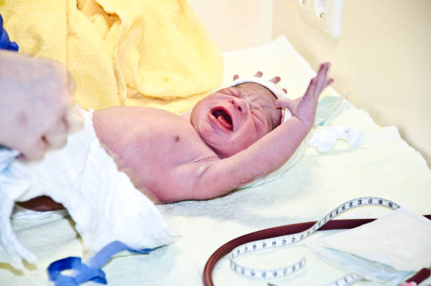 istock New-born baby with Down Syndrome crying and wailing while undergoing first medical examination 1157301778