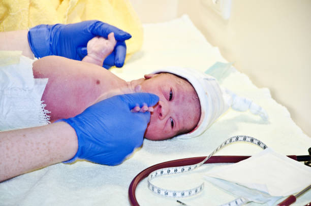 istock New-born baby with Down Syndrome undergoing first medical examination 1157301866