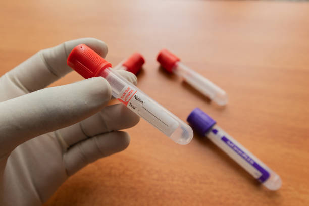 istock Pro-coagulation Plain Clot Activator blood collection tube,with red plastic stopper held by hand In Laboratory 1157322988