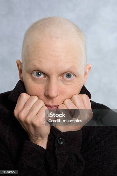 Cancer Patient Head And Shoulder Studio Portrait Stock Photo - Download Image Now - Adult, Adults Only, Attitude