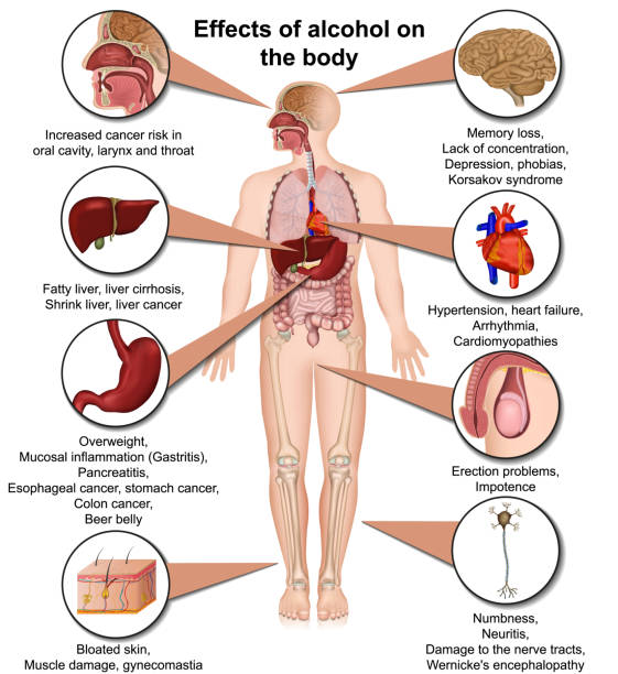 Effects of alcohol on the body 3d medical vector illustration isolated on white background eps 10 infographic Effects of alcohol on the body 3d medical vector illustration isolated on white background eps 10 infographic alcoholism stock illustrations