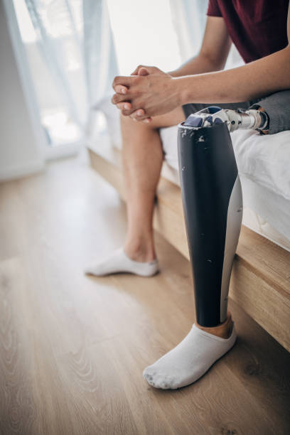 istock Man with amputee leg sitting on the bed 1157752657