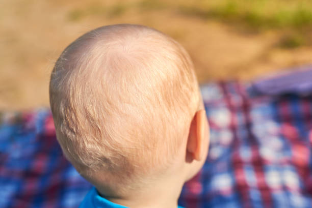 istock Children's nape with sparse white hair, close-up 1158063725