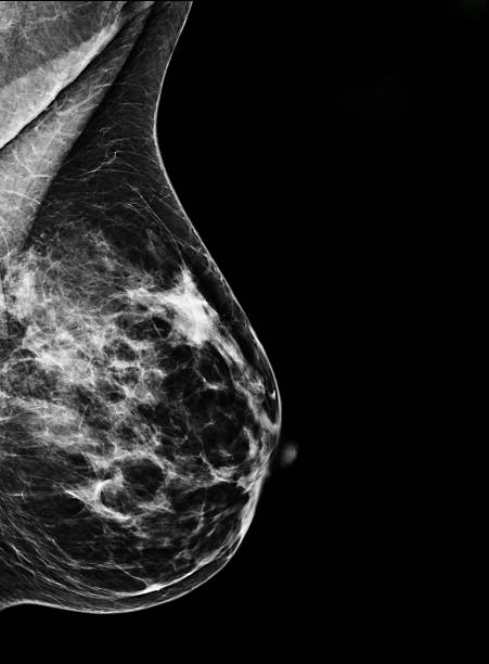 Digital Mammography stock photo