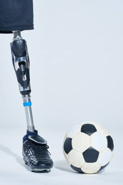 istock Football ball near artificial leg 1158157746