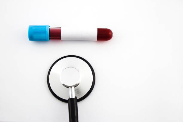 istock blood test tube and stethoscope 1158207913