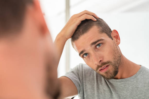 junger mann überprüft haare im spiegel - glatzenbildung stock-fotos und bilder
