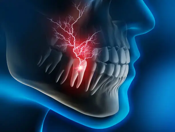 Close-up of a painful tooth in the lower jaw against a dark background - 3D illustration