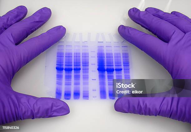 손 보호 장갑 쥐다 블루때묻은 전기영동 젤 DNA 염기서열 젤에 대한 스톡 사진 및 기타 이미지 - DNA 염기서열 젤, Electrophoresis, 단백질