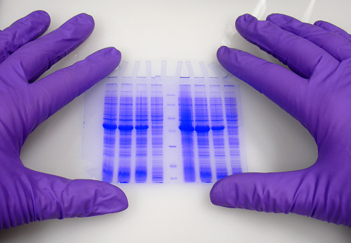 Hands wearing protective gloves hold blue-stained electrophoresis gel with separated proteins.