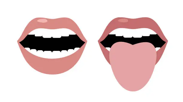 Vector illustration of Smile with open mouth and a mole on the left cheek. Monroe Marilyn. Open mouth and tongue sticking out. Changes in color and appearance in diseases. Vector image. Flat design.