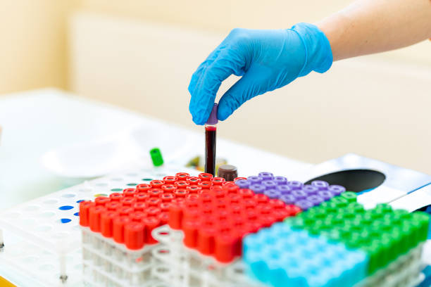 istock Female nurse puts blood samples in tubes onto a special rack on a table. 1158555261