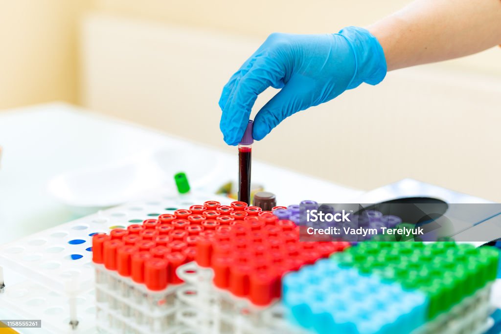 Female nurse puts blood samples in tubes onto a special rack on a table. Female nurse puts blood samples in tubes onto a special rack on a table. Doctor's hands in blue latex gloves put the test tube in a rack with many colorful vials in a laboratory. Close-up. Analyzing Stock Photo