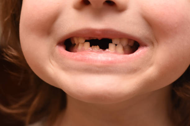 istock Happy boy smiling and showing his milk-tooth that has fallen out. 1158558184